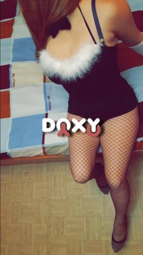 Фотография номер 5 - Зайка, 24 года