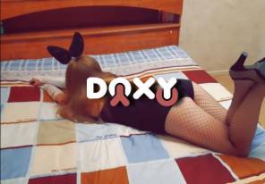 Фотография номер 6 - Зайка, 24 года